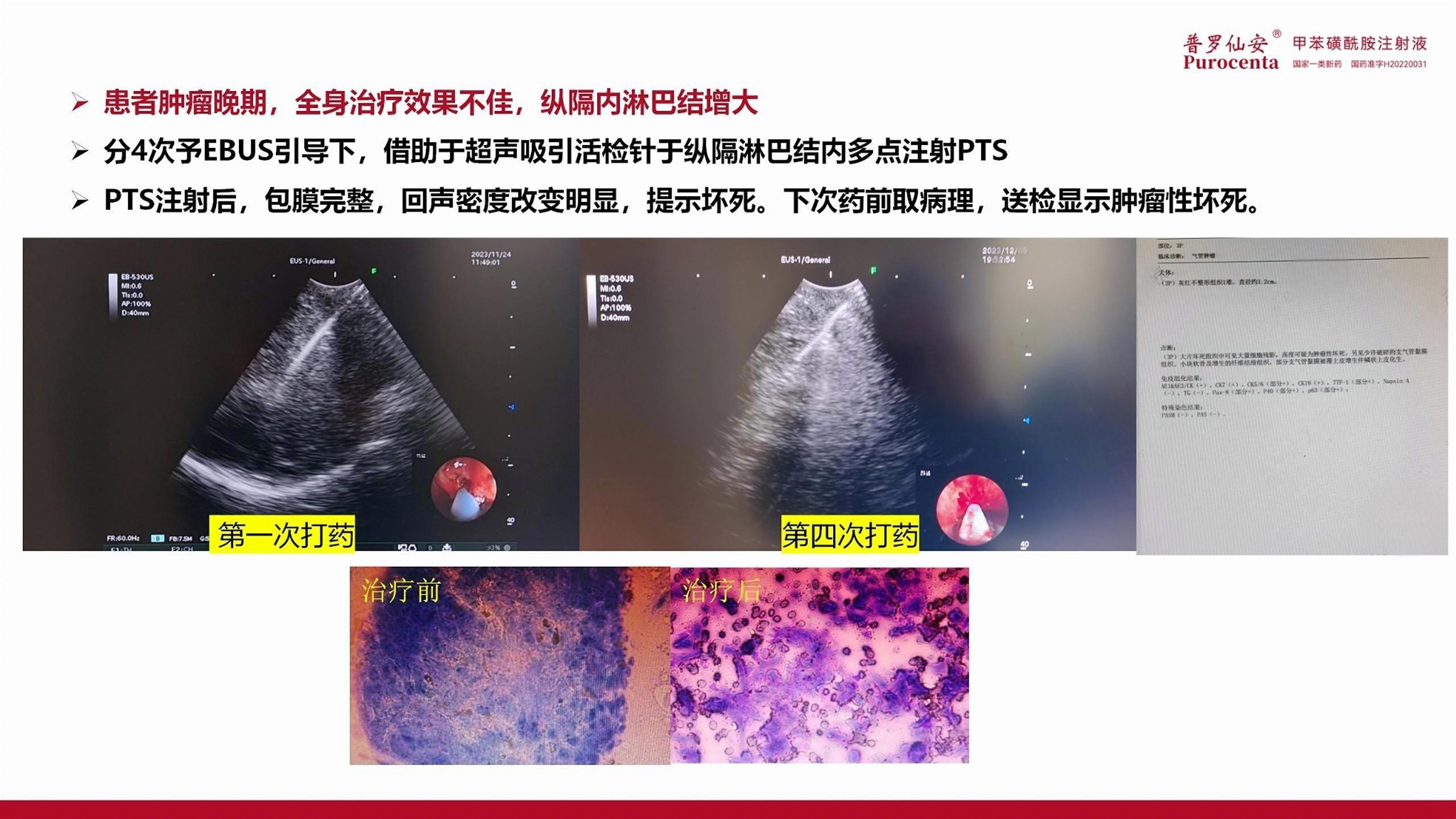 普罗仙安PTS培训PPT03151_07.jpg